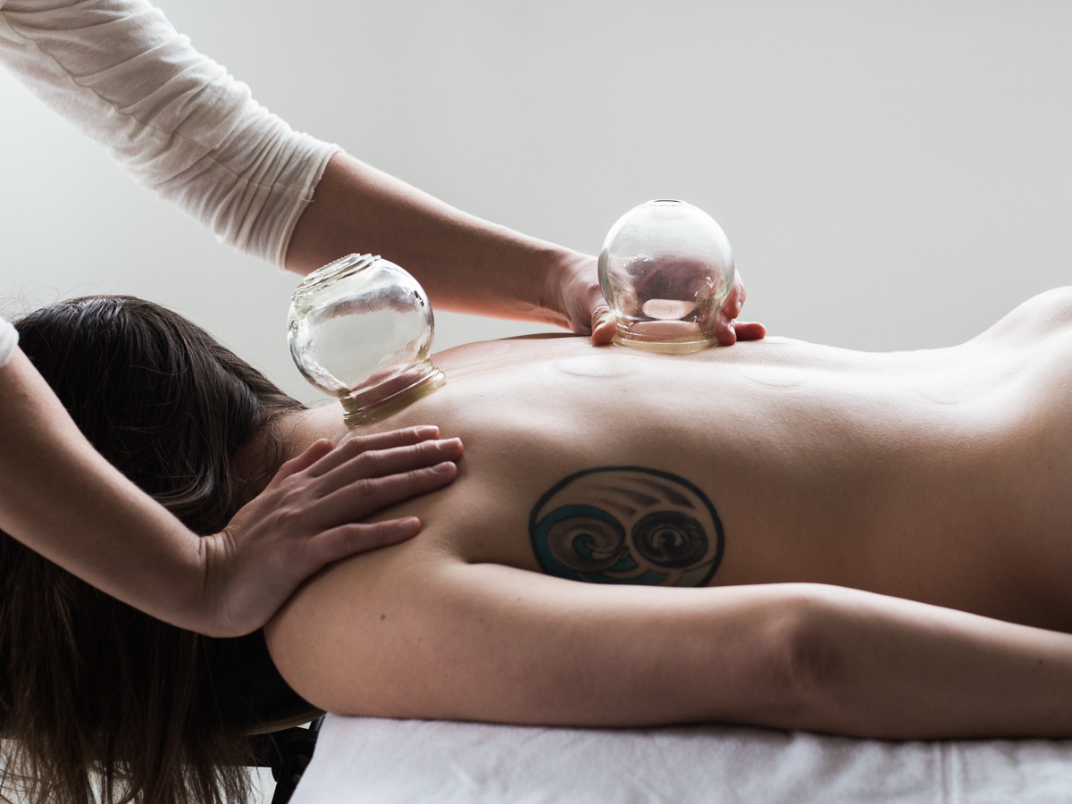 The Power of Cupping for Inflammation Relief